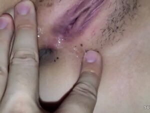 Thumb 1