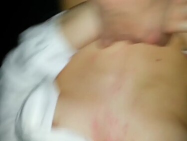 Thumb 1